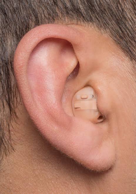 Custom-fit hearing aid worn discreetly in the ear at Neuma Hearing Aid Clinic